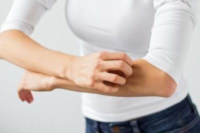 Egzama belirtilerine dikkat: Soğuk havalarda artış gösteriyor