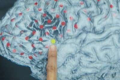 'Covid-19 geçirenlerin beyninde küçülme tespit edildi'