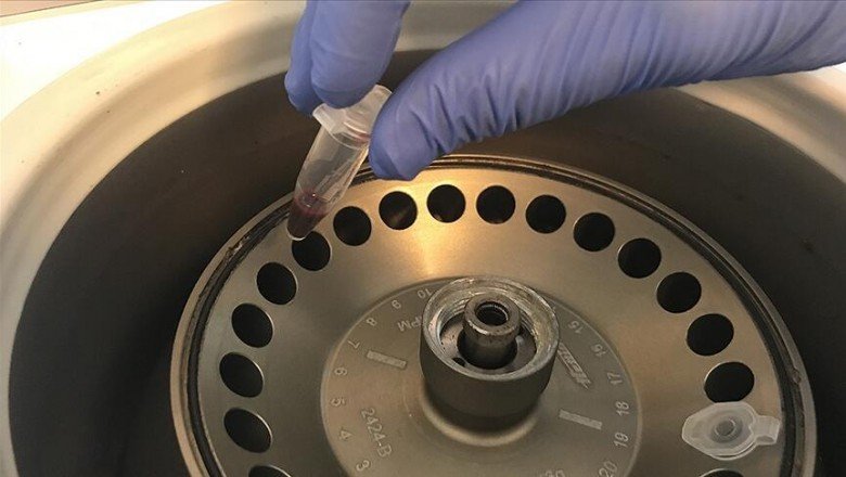 Serebral palsi tanısı için &amp;#39;genetik test yaptırın&amp;#39; uyarısı