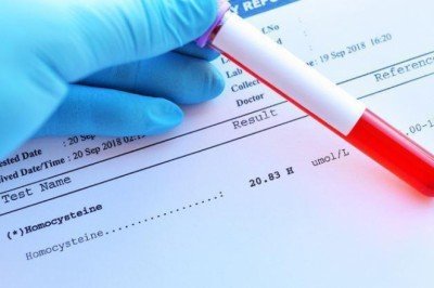 Sinsi tehlike kolesterol