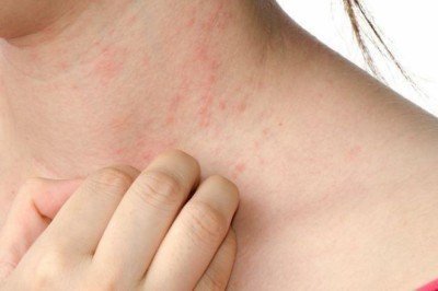 Uzmanından ‘uyuz böceği’ uyarısı