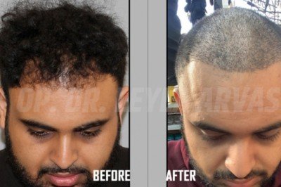 SAĞLIĞINIZDAN TAVİZ VERMEDEN