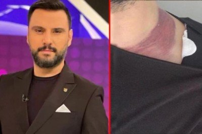 Yağ aldırma ameliyatında ölümden dönen Alişan'dan doktora rekor tazminat davası - Haberler.com