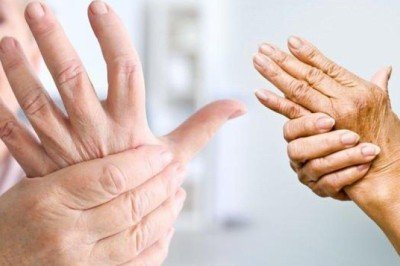 Dünyada 350 milyon kişide görülen artrit hastalığına dikkat!