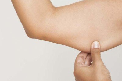 Uyluk ve kol sarkmalarından kurtulmanın yolları