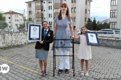 Dünyanın en uzun boylu kadını da Türk