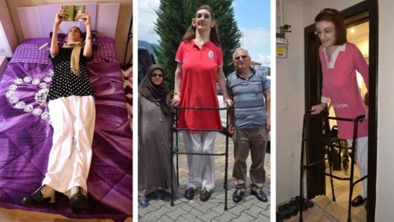 Dünyanın en uzun boylu kadını Rümeysa Gelgi, Guinness Rekorlar Kitabı'na girdi - Cumhuriyet