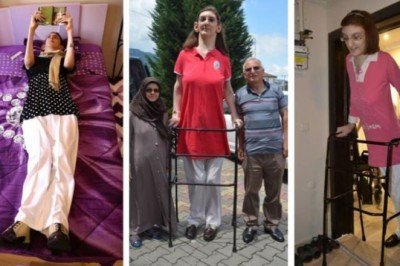 Dünyanın en uzun boylu kadını Rümeysa Gelgi, Guinness Rekorlar Kitabı'na girdi - Cumhuriyet