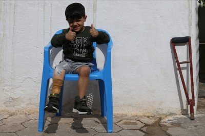 Suriyeli Muhammed hayata tutunacağı protez bacağa kavuştu