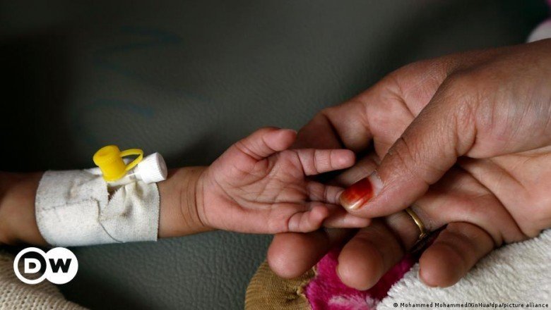 Dünyada açlık alarmı