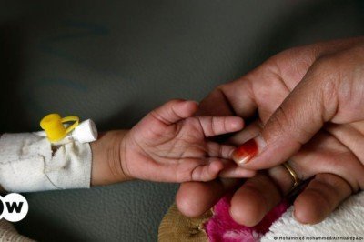 Dünyada açlık alarmı