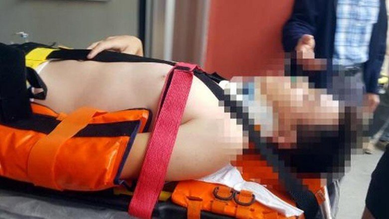 Kayseri'de korkunç olay! 4’üncü kat balkonundan düştü