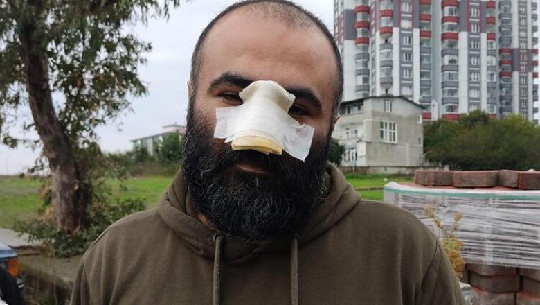 İş insanı dehşeti yaşadı! 'Kendime aynada bakamıyorum'