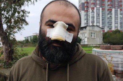 İş insanı dehşeti yaşadı! 'Kendime aynada bakamıyorum'