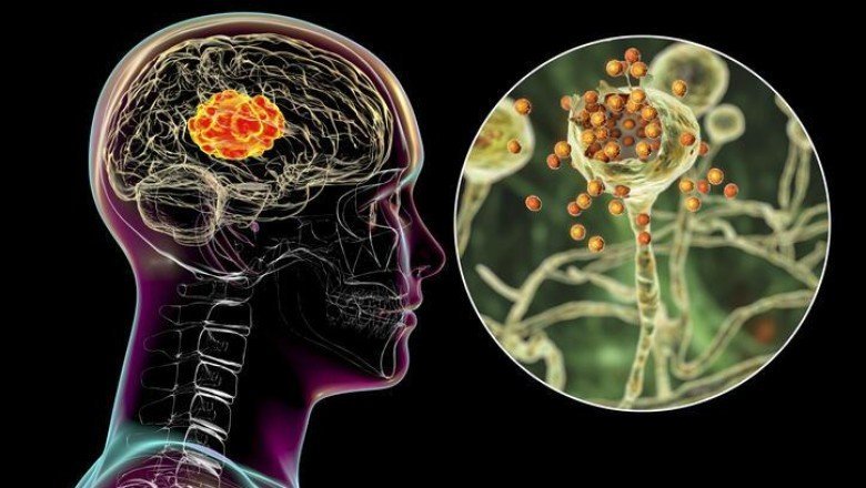 Koronavirüs beyni küçültüyor! 'Covid geçirdikten sonra mutlaka uzmana başvurun...'