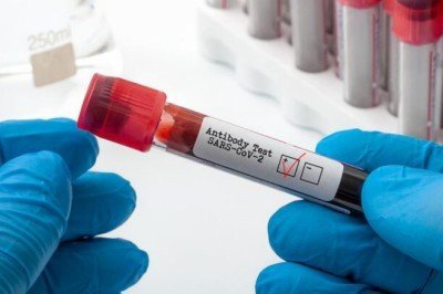 Covid-19'a karşı ‘antikor kokteyli’ müjdesi! 12 aya kadar koruma sağlıyor...