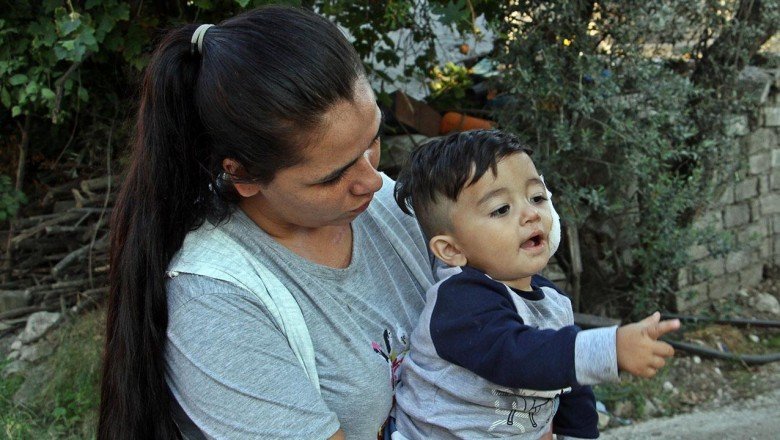 Pitbull saldırdı, baba ve 11 aylık oğlu hastanelik oldu