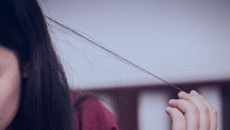 Bu hastalık saç baş yolduruyor! Karantina stresi yüzünden neredeyse kel kaldı