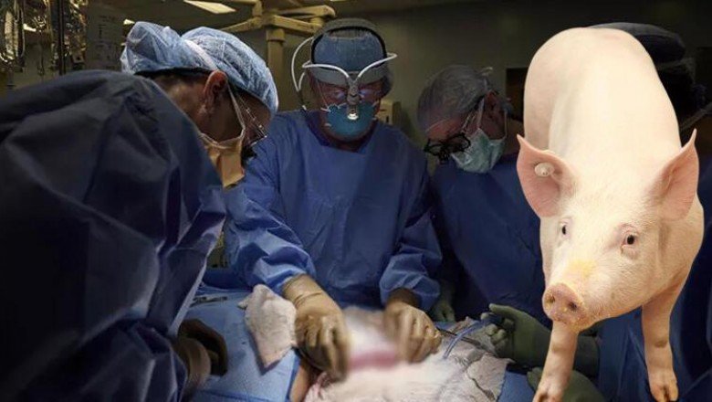 Domuzdan insana organ nakli! Türkiye için de umut oldu...