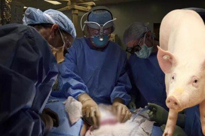 Domuzdan insana organ nakli! Türkiye için de umut oldu...