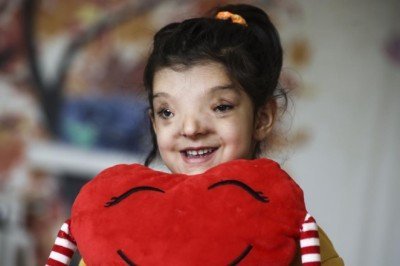 Minik Ayşenur'un normalden daha ayrık olan gözleri ameliyatla yaklaştırıldı