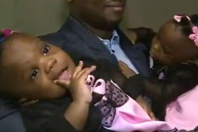 Kamerunlu siyam ikizleri İstanbulda ayrıldı