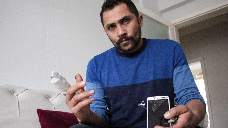 Patlayan powerbank parmağını kopardı