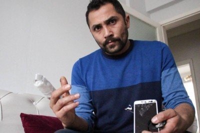 Patlayan powerbank parmağını kopardı