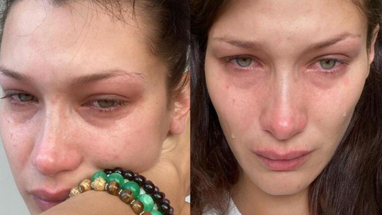Bella Hadid'in iki gözü iki çeşme: Her gün, her gece ağlıyorum - Hürriyet