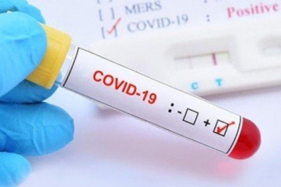 Rusya'da koronadan 1241 kişi hayatını kaybetti