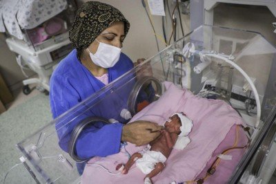 Ölüm riski bulunan bebekler ışın tedavisiyle kurtarıldı