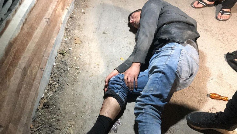 Ev sahibiyle karşılaşan hırsız kaçmak isterken balkondan düştü