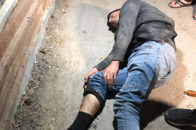 Ev sahibiyle karşılaşan hırsız kaçmak isterken balkondan düştü