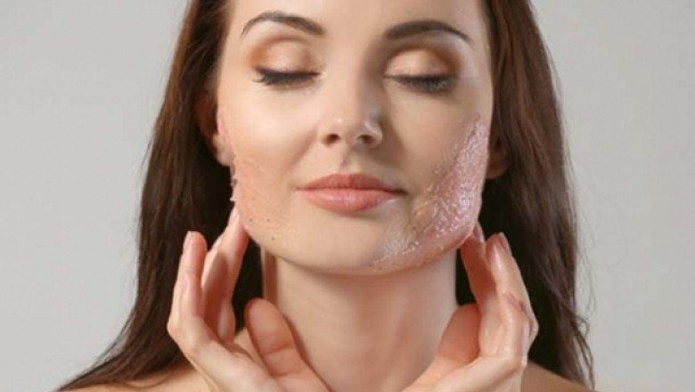 Cosmelan – Dermamelan Nedir?