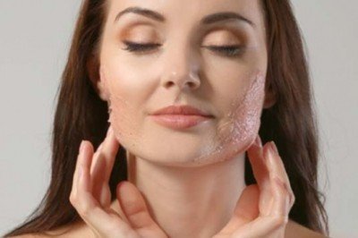 Cosmelan – Dermamelan Nedir?