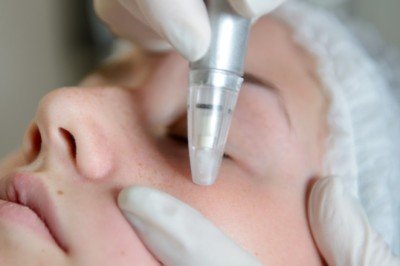 Dermapen ile Cilt Gençleştirme (Dermaterapi)