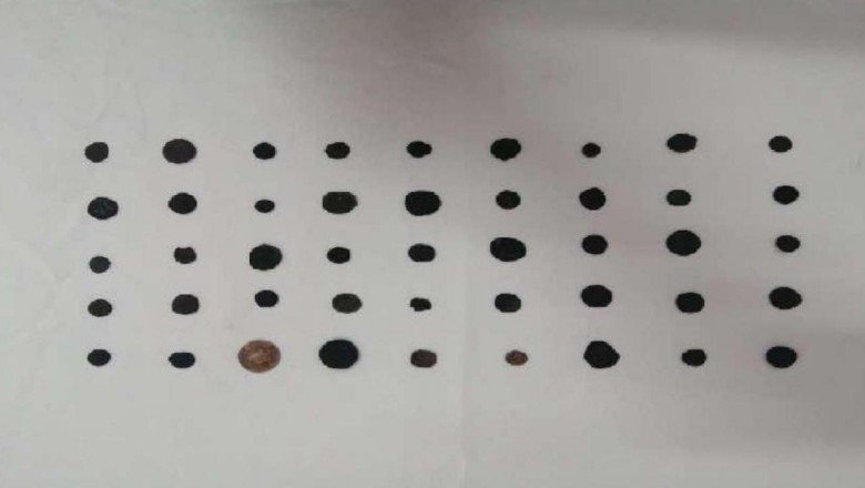 Gaziantep'te Roma dönemine ait olduğu değerlendirilen 45 sikke ele geçirildi