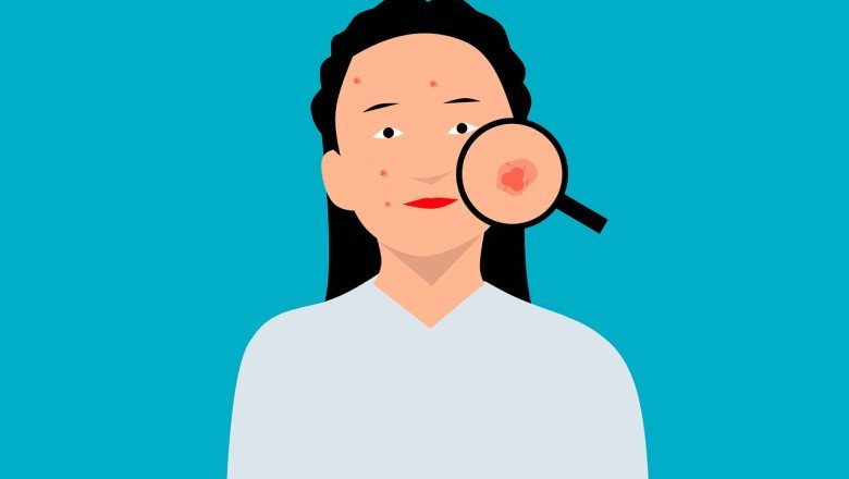 Herhangi bir şeye alerjiniz var mı?