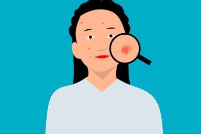 Herhangi bir şeye alerjiniz var mı?