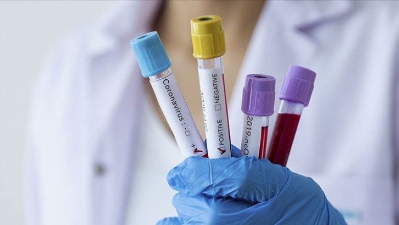 Prof. Dr. Tecer: Havada koronavirüsün RNA'sına rastladık