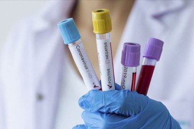 Prof. Dr. Tecer: Havada koronavirüsün RNA'sına rastladık