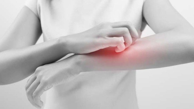 Yara izleri nasıl geçer?