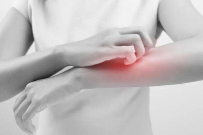 Yara izleri nasıl geçer?