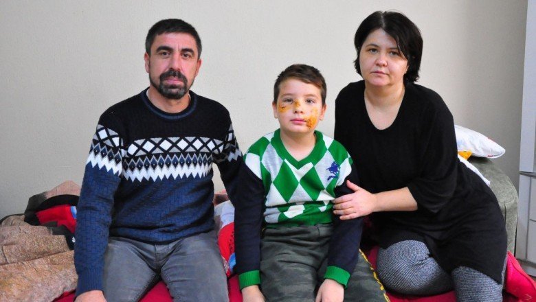 Köpek saldırısına uğrayan Mert'in yüzüne 60 dikiş atıldı