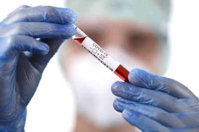 Bilim Kurulu üyesi Kara: Omicron'da klinik tablo ağır değil