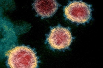 Rusya’da ilk Omicron vakası bulundu