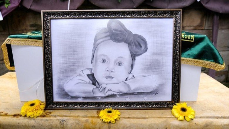 SMA hastası Güneş bebek kurtarılamadı