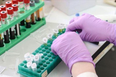 Evlilik öncesi SMA testleri zorunlu olacak: İşte detayları...