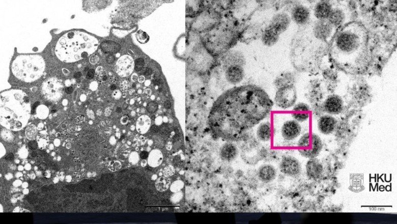 Omicron varyantının görüntüsü yayımlandı