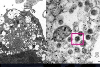 Omicron varyantının görüntüsü yayımlandı